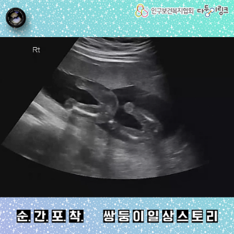 순간포착 쌍둥이일상스토리 이벤트 당선작