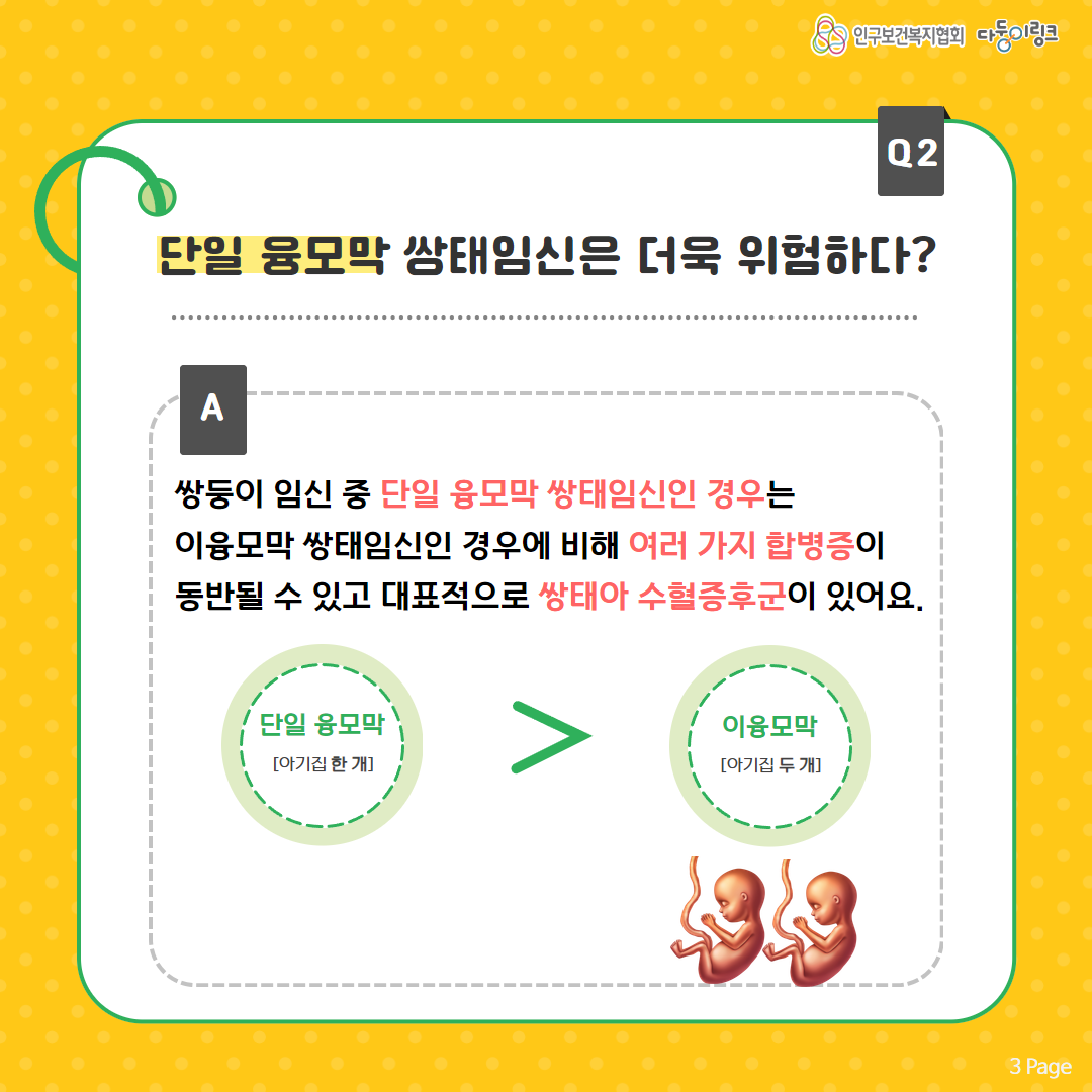 단일 융모막 쌍태임신은 더욱 위험하다
