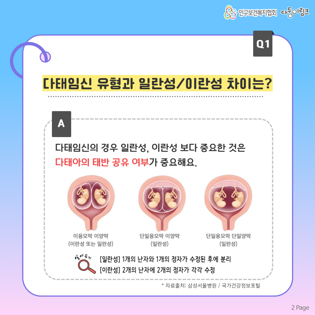 다태임신 유형과 일란성이란성 차이는